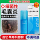 優(yōu)立特馬拉色菌毛囊炎專用抑菌噴劑液頭皮前胸后背真菌頭部膿包疙瘩LY 一盒【基礎(chǔ)裝 紅痘刺痛癢】不滿可退