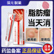葆元醫(yī)生【官方旗艦店】葆元醫(yī)生脂肪瘤消瘤膏去除神器纖維粉瘤皮脂腺囊腫 1盒體驗(yàn)裝貴在運(yùn)費(fèi)