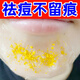 MN祛痘精華液痘印坑修復(fù)淡化去閉口粉刺收縮毛孔男女士 3瓶 【祛痘不留印】
