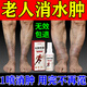仙懷堂消腫去水腫下肢浮腫腿腫去水腫專用老人腳腫藥利尿排水全身噴霧劑 1瓶【體驗裝】貴在運費