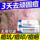 南京同仁堂【強效】額頭上長痘痘頭部粉刺脂肪粒內(nèi)分泌失調(diào)祛痘神器快速消痘 1盒裝【體驗裝】正品保證