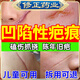 修正凹陷疤痕生長修復(fù)填充凝膠祛疤膏痘坑修復(fù)凹洞兒童臉部醫(yī)用填充劑 一盒【體驗裝】