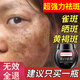 南京同仁堂美白祛斑霜美白淡化老年黃褐雀斑黑色素修護(hù)淡化細(xì)紋男女士50g