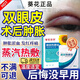 葵花雙眼皮術(shù)后熱敷眼罩熱敷蒸汽眼罩雙眼皮術(shù)后消腫神器干眼癥麥粒腫 眼部熱敷貼（一盒6袋）
