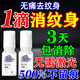 洗紋身藥水正品去紋身專用修復膏藥紋身去除液不留疤痕神器消除 1盒【一滴見效】