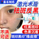 藤石制藥激光祛斑后反黑醫(yī)用淡斑修復(fù)產(chǎn)品控色霜點斑控黑色素淡化去黑印XY 單盒 體驗裝(升級款)