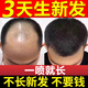 奕康本草生發(fā)育發(fā)液激活毛囊增發(fā)密發(fā)長(cháng)發(fā)劑洗發(fā)液生發(fā)男專(zhuān)用防脫生發(fā)增發(fā)密發(fā)白發(fā)藥品脫發(fā)嚴重男女士專(zhuān)用中藥生發(fā)增發(fā)育發(fā)洗發(fā)水精華液 三盒裝【發(fā)縫寬必入】買(mǎi)二送一 100%防脫育生發(fā)增發(fā)密發(fā)液