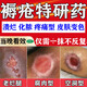 時(shí)珍康醫用褥瘡(發(fā)貨特效)專(zhuān)用藥褥瘡膏老人臀部外用褥瘡防壓瘡皮膚潰爛去腐生肌膏促進(jìn)傷口愈合結痂消炎氧化鋅軟膏1盒【老人臥床不起長(cháng)褥瘡】當天看效