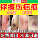 擦傷摔傷除疤膏臉部腿部摔傷破皮祛疤痕黑色素沉著(zhù)淡化修復除疤去除黑印凝膠 單盒裝