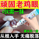 水楊酸軟乳膏正品官方旗艦店化角質去疣雞眼藥百分之15抑菌醫(yī)用 10g x 1盒 【皮膚增厚疼痛】 中藥