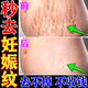 華林堂妊娠紋油孕婦專(zhuān)用妊娠紋修復霜孕婦油預防妊娠紋消除去妊娠紋 20g 1支 【單盒裝】