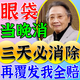 歐誘去眼袋消除重度眼袋專用眼袋霜去大眼袋嚴(yán)重中老年祛男女士貼神器 【眼袋消腫液最好的眼霜】1盒 眼袋貼去眼袋消除重度嚴(yán)重黑眼圈