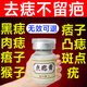 茉博士香港大藥房去痣點痣膏藥水臉部不留疤黑痣無痛修復(fù)液