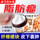 北京同仁堂脂肪瘤醫(yī)用膏藥特用皮下多發(fā)性脂肪瘤粒消去除囊腫硬包塊脂肪康 1盒裝【輕度癥狀適用】 【100%發(fā)貨特效快】去除神器硬塊皮脂腺囊腫脂肪粒