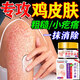 巖井昃弘雞皮膚去除神器兒童去雞皮膚毛囊角質(zhì)疙瘩大腿皮膚干燥身體乳藥膏 三盒裝【98%顧客使用】