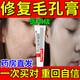 阿達帕林凝膠醫(yī)用收縮毛孔粗大修復細致祛痘印修復淡化痘印痘坑修復藥膏祛痘消炎痤瘡?？破つw用藥祛痘印黑頭 3盒【堅持一個月 毛孔再見】東京直營官方旗艦店