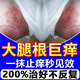 APGMA大腿內(nèi)側(cè)瘙癢紅疹越抓越癢股癬蘚藥膏大腿內(nèi)側(cè)真菌感染腹股溝股癬專用大藥膏腿根內(nèi)側(cè)去黑色素去除大腿內(nèi)側(cè)潮濕男人專用止癢去i根 【特惠：拍1發(fā)3】潮濕瘙癢燒襠