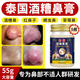 克頓默奧酒糟鼻草莓鼻紅腫玫瑰痤瘡紅鼻子專用去粉刺黑頭紅血絲螨蟲修護(hù)軟 五盒鞏固裝（重度型） 搭紅鼻子酒糟鼻頭紅腫消炎產(chǎn)品用