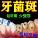 牙菌斑牙膏兒童牙齒美白神器減少牙垢牙漬牙黃牙齒黑斑益生菌牙膏 【實(shí)惠裝】買(mǎi)二送一