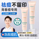 BEAUTY NOTES青少年祛痘膏男女學(xué)生護膚品12-18歲青春痘粉刺痘坑30g