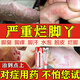 達(dá)克寧腳氣藥止癢脫皮爛腳丫真菌感染治療腳氣特專用效藥腳氣藥止癢脫皮爛腳丫抗真菌感染根專硝酸咪康唑乳膏 1盒【達(dá)克寧治腳氣】