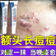 南京同仁堂青春痘祛痘膏藥男女學(xué)生青少年額頭長(cháng)上長(cháng)痘痘閉口粉刺去豆豆正品 單盒裝【體驗裝】南京同仁堂