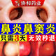 北京協(xié)和醫(yī)學(xué)院鼻竇炎專用的藥100%過敏性鼻炎兒童成人蒼耳子通鼻貼進(jìn)口噴劑霧 特效三盒裝【一噴見?！繜o效退 治過敏性鼻炎鼻竇炎鼻子癢流鼻涕