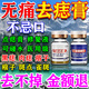 點(diǎn)痣膏醫用專(zhuān)用官方正品點(diǎn)痣水無(wú)痛無(wú)痕去痣膏去黑痣臉部不留疤痕 三盒裝【買(mǎi)二送一】（藥監備案）