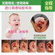 其他耳廓矯正器寶寶耳朵矯糾正器嬰兒耳畸形新生兒垂耳招風(fēng)耳膠帶塑形 一個(gè)三抓耳夾送膠帶和教程