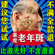 萊覽奧蓋祛斑霜美白淡化老年黃褐雀斑黑色素曬斑去祛斑男女士專用醫(yī)用正品 買2送1【多數(shù)顧客購買】 老人斑臉部手背效果最好的產(chǎn)品