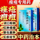 醫(yī)用痤瘡中藥去青春痘粉刺紅腫硬疙瘩痘印祛痘痘消炎痤瘡膿皰瘡去痘印青少年專用清熱暗瘡?fù)琛疽曈X特效】 3盒【療程裝】
