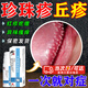 修正珍珠疹去除非藥男丘疹去除冠狀溝顆粒珍珠粒龜頭小肉粒包皮炎非藥 單盒裝【龜頭小肉粒專(zhuān)用】