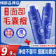 傾齡毛囊凈祛痘精華液噴霧深層清潔毛孔補水滋潤保濕店 1瓶*100ml【毛囊凈祛痘精華】 保證