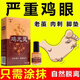 雞眼專用液雞尤靈手指肉粒疙瘩腳趾底貼硬厚老繭去除水硬皮軟化劑 單盒裝【體驗裝】正品保證
