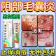 陰部毛囊炎專(zhuān)用藥私密處止癢紅腫疼痛有疙瘩男女性外陰瘙癢婦科專(zhuān)用私處止癢殺菌藥膏莫匹羅星軟膏 1盒【國藥正品 藥房直發(fā)】