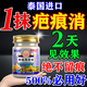 香草雨露 XCYL去疤痕藥膏去疤痕修復凝膠醫(yī)院專用去疤膏修復兒童祛疤痕修復凝膠 1盒【修復新舊疤痕增生凸起】 剖腹產(chǎn)祛疤痕修復凝膠