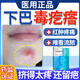 下巴紅腫硬痘痘專(zhuān)用大個(gè)的下巴毒疙瘩火癤子祛痘脖子后面長(cháng)痘有藥監備案白色膿包紅腫流膿毒氣疙瘩痘痘N3 1盒 贈棉簽【體驗裝】下巴毒疙瘩火癤子