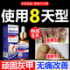 鑫博士灰指甲專門用重度灰指甲真菌感染脫甲壞甲殺菌抑菌液護(hù)理霜30ml