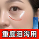 MN淚溝填充面部膠原蛋白豐盈額頭法太陽(yáng)穴令紋臉頰眼窩凹除陷去神器 2盒【去眼周輕微淚溝】修復(fù)