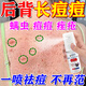 后背痘痘藥膏背部毛囊炎長痘痘祛痘噴霧前胸后背祛痘印除螨蟲噴劑 特效:買2送1【一噴見效】