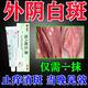 外陰白斑專用藥膏止癢去到根萎縮營養(yǎng)不良修復(fù)膏消白軟i膏治療外陰白斑特正效藥陰部瘙癢私處止癢維a酸乳膏 1盒【外陰長白斑】醫(yī)用級藥膏
