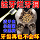 蛀牙洞修·復齲齒爛牙壞洞兒童成人防蛀牙膏治療清理牙蟲(chóng)的藥醫用 一盒裝【富人的牙膏】