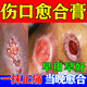 擦傷破皮外用藥傷口快速愈合藥長(cháng)肉快的藥傷口愈合快速結痂促進(jìn)長(cháng)肉消炎擦傷疤痕修復抗生素消炎藥紅霉素軟膏 1盒【傷口化膿消炎藥】醫用級