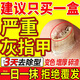 灰指甲100%專用的藥視覺特效重度灰指甲藥膏指甲真菌感染脫甲壞甲亮甲增厚真菌感染根藥治硝酸咪康唑乳膏 1盒裝【建議多盒用藥 發(fā)貨特效】重度灰指甲