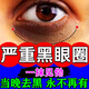 秋雅奈緒黑眼圈重度去除眼霜淡化細紋提拉緊致黑眼圈眼袋眼紋遮瑕女士熬夜 一盒【體驗裝】輕度黑眼圈 黑眼圈重度去除黑色素