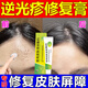 修正逆光疹修復(fù)皮膚屏障額頭小顆粒痘痘臉上長疙瘩閉口粉刺泛紅軟膏 1盒裝【建議3盒使用】