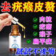 內(nèi)廷上用皮贅肉粒去除神器去扁平疣絲狀疣脖子上長小疙瘩肉瘤瘊子疣體脫落 克尤液【1盒】