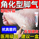 酮康唑乳膏角化型腳氣專用藥頑固性真菌感染角質(zhì)增厚脫屑干燥腳氣藥止癢脫皮腳后跟干裂起硬皮足跟開(kāi)裂專用藥 1盒【皮膚粗糙有鱗屑】建議多盒