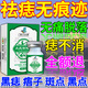 廣雅千方百劑點(diǎn)痣膏無痕去痣神器專用臉部不留疤藥正品水無痛祛痣黑痣疣雀斑點(diǎn) 規(guī)格 1盒【少量斑痣】體驗(yàn)