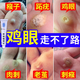 水楊酸軟膏%15雞眼膏去腳根肉刺藥膏無(wú)痛脫落連草根就拔 雞眼100去除特藥效皮膚用藥 非處方藥 100％正品1盒裝【國藥OTC認證】